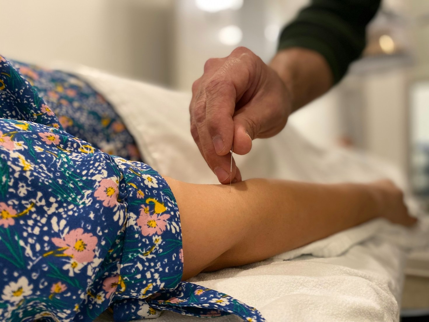 Personalized Acupuncture: Tailored for Your Needs